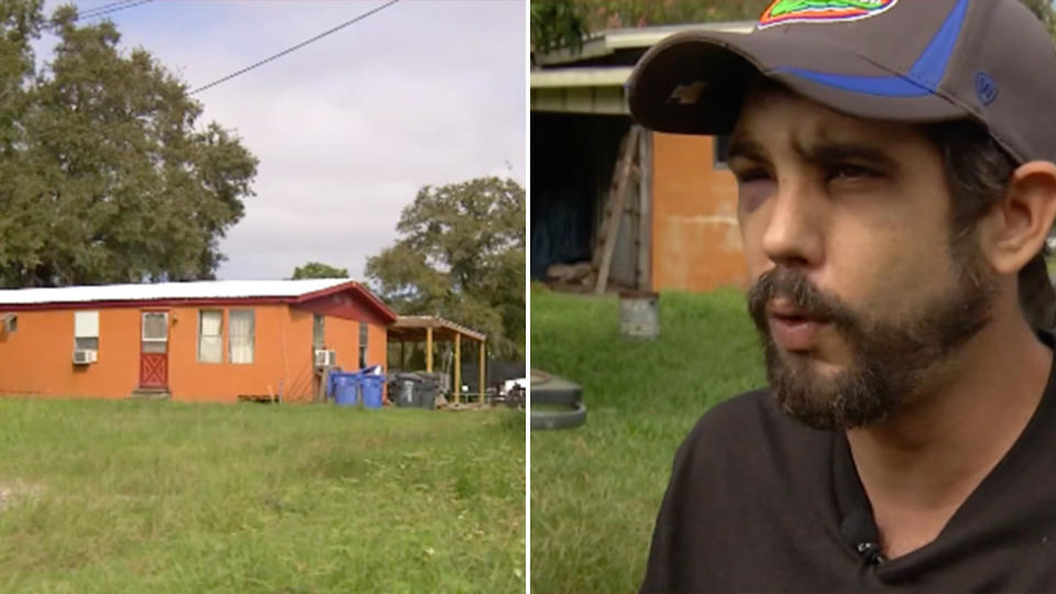 Jeremy King is pictured outside of his Florida home. Bruising can be seen around his eyes. Source: Bay News 9.