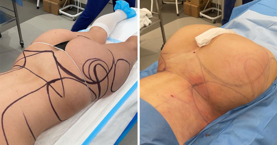 Before and after Cathy’s surgery. 