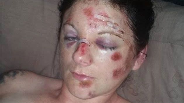 Elisha Sherwood says she was bashed by police for half an hour. Photo: Facebook