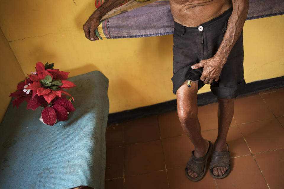 Jose Calderon lifts his shorts to show tubes that are part of his prostrate treatment in Maracaibo, Venezuela, Nov. 20, 2019. The 86-year-old said the tubes should be changed monthly, but he's only been able to afford for them to be replaced twice this year. (AP Photo/Rodrigo Abd)