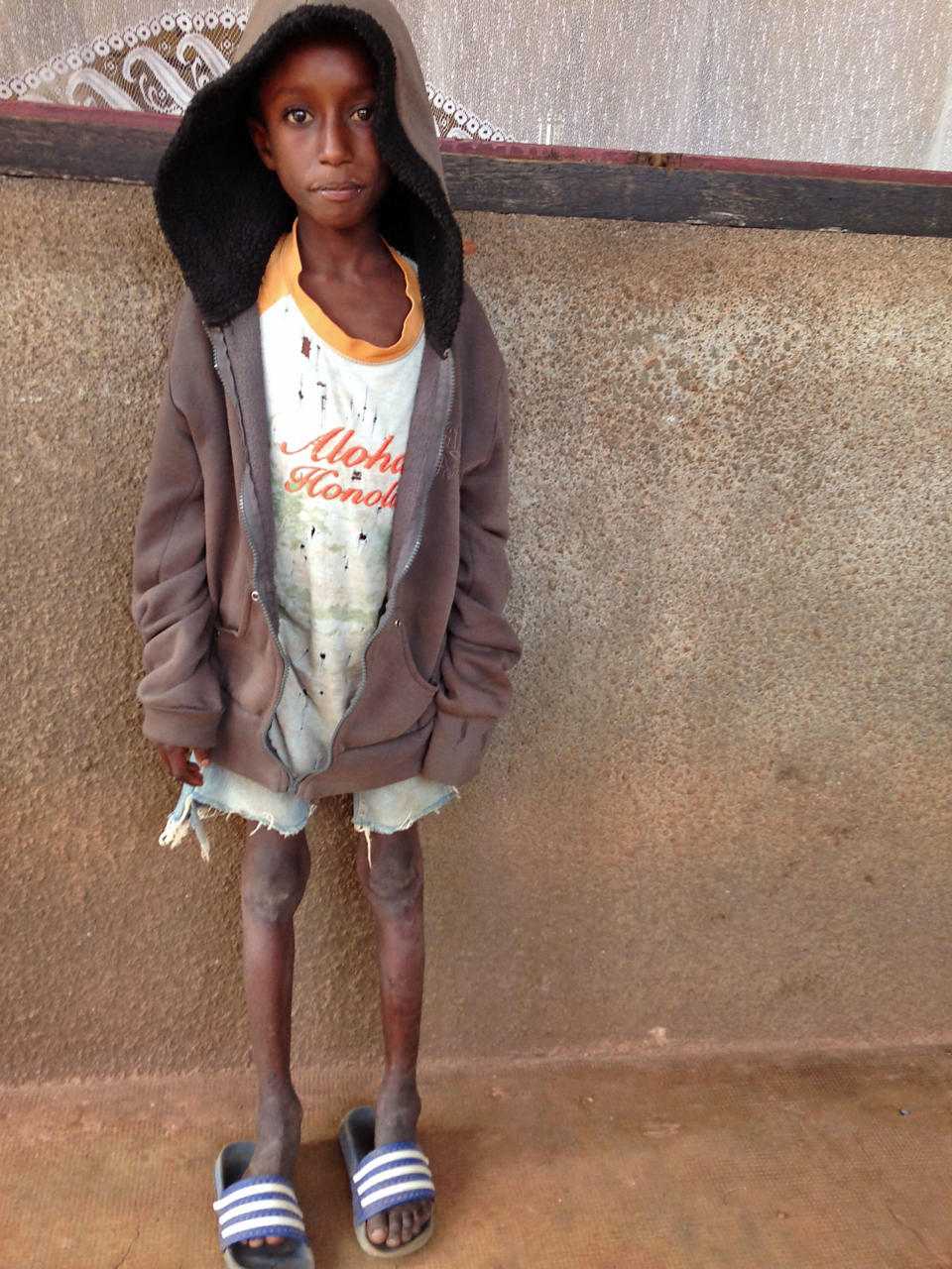 Ibrahim Adamou stands near the Catholic church in Carnot a town 200 kilometers (125 miles) from the Cameroonian border, in the Central African Republic, Monday, Feb. 24, 2014. Ibrahim Adamou wasn’t sure whether any of his five siblings had survived the attack by Christian militiamen who opened fire on his family as the group of herders journeyed on foot. His parents already had been killed in front of him. (AP Photo/Steve Niko)