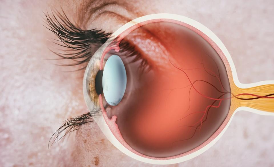 While many will recover in three to six months, permanent vision loss is a possibility. Shutterstock