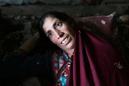 Ruqayya Bibi, 31, who was injured when her 4-year-old son found an unexploded cluster bomb that looked like a toy and it exploded in his hands at home, lays on a bed in village Jabri, in Neelum Valley