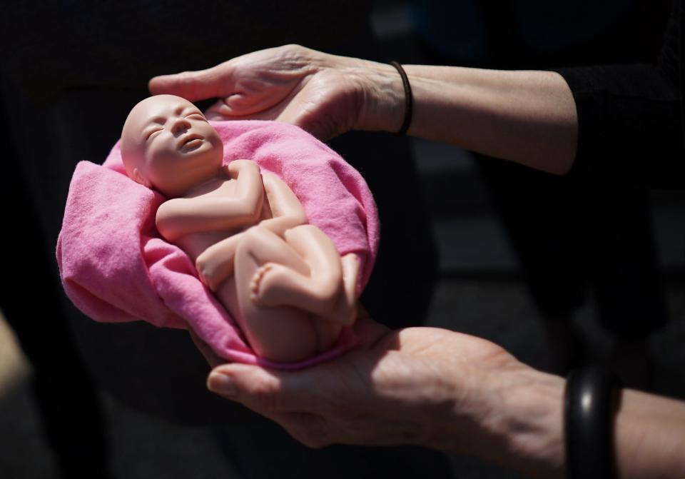 An anti-abortion activist holds a model of a fetus during a protest in Washington, D.C., on May 7, 2015. Many Christians that oppose abortion believe life begins at conception.