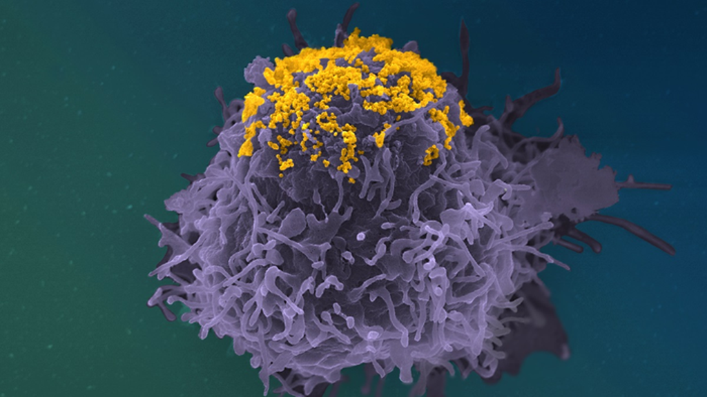 HIV particles (in yellow) accumulating on the surface of an infected cell (in purple) (Stéphane Fremont, Jérémy Dufloo, Arnaud Echard, Timothée Bruel, Olivier Schwartz, Jean-Marc Panaud, Institut Pasteur)