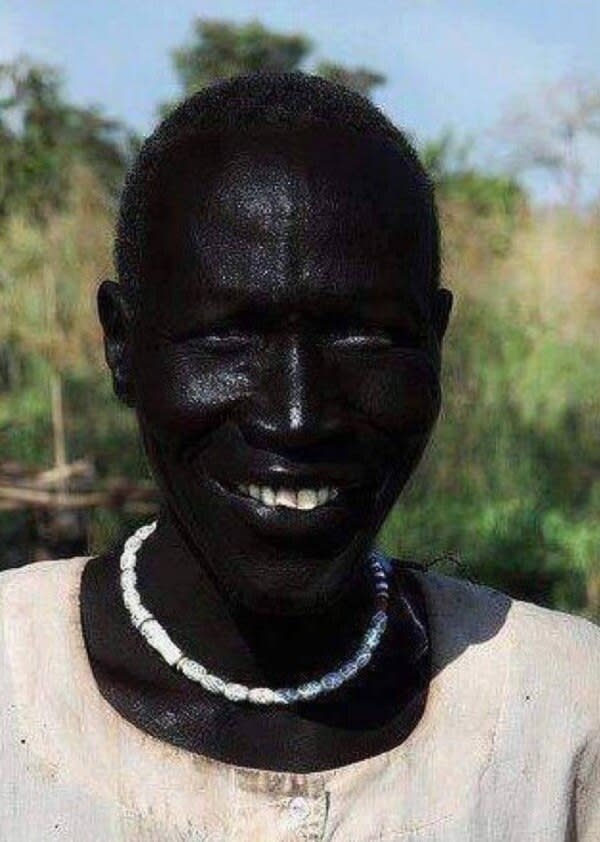 Who Is The Blackest Person In The World?