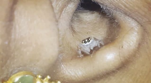 The woman says she could feel the spider inside her ear. Source: Newsflare