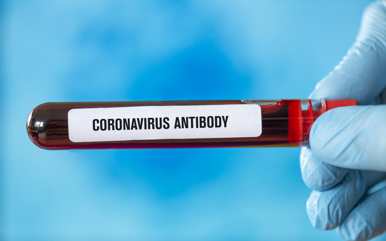 Covid-19 blood sample, antibody.