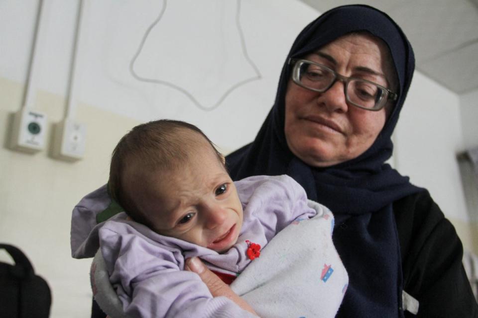 A Palestinian child, who is suffering from malnutrition, receives healthcare at Kamal Adwan Hospital in northern Gaza Strip in April, amid widespread hunger, during the ongoing conflict between Israel and Hamas (Reuters)