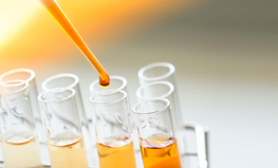 equipment and glassware for test product extraction and orange color solution, in the chemistry laboratory.