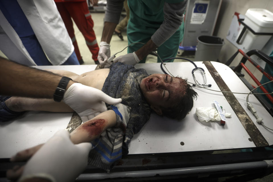 A Palestinian child wounded in the Israeli bombardment of the Gaza Strip receives treatment at the Nasser hospital in Khan Younis, southern Gaza Strip, Friday, Dec. 29, 2023. (AP Photo/Mohammed Dahman)