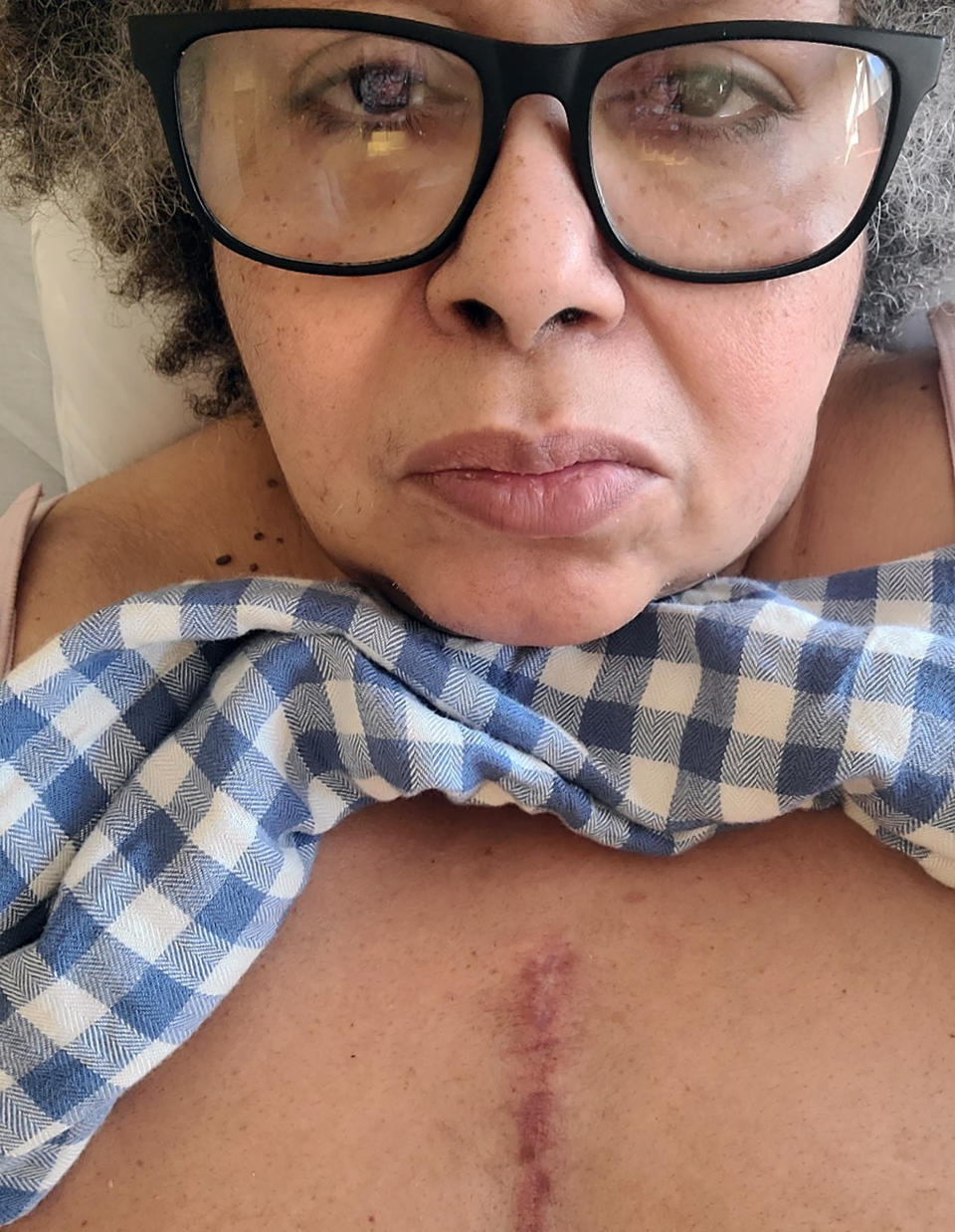 Yvelisse Boucher worried that the scar from open heart surgery would disfigure her. But she doesn't mind it now that her health is improving. (Courtesy Yvelisse Boucher)