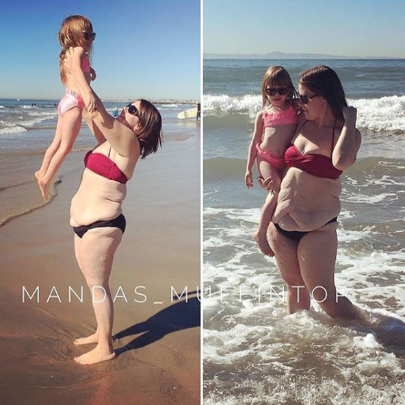 <p>“Me di cuenta de mi piel flácida y los problemas médicos que la acompañaban (erupciones, llagas, infecciones), pero tomé la decisión de aprender a amarme como era. Decidí estar en paz con mi cuerpo, porque trabajé duro para perder peso y estar más saludable”, comentó Amanda al portal <a rel="nofollow noopener" href="https://www.buzzfeed.com/morganshanahan/this-body-positive-instagrammer-is-being-body-shamed-for?utm_term=.knkyAv3PA#.acBY6ENk6" target="_blank" data-ylk="slk:BuzzFeed;elm:context_link;itc:0;sec:content-canvas" class="link "><em>BuzzFeed</em></a>.<br><br></p>
