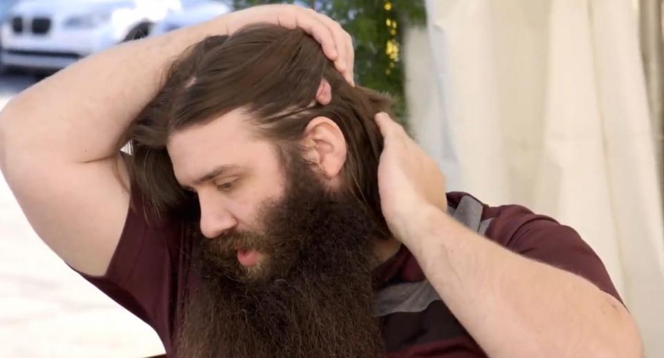 A man parts his hair behind his head to show one of the cysts growing from his scalp during an episode of "Dr. Pimple Popper."