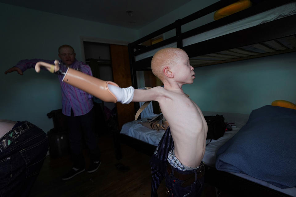 <p>Baraka Lusambo, 7, a Tanzanian with albinism who had an arm chopped off in a witchcraft-driven attack, puts on his prosthetic arm at the Global Medical Relief Fund house in the Staten Island borough of New York City, June 3, 2017. (Photo: Carlo Allegri/Reuters) </p>