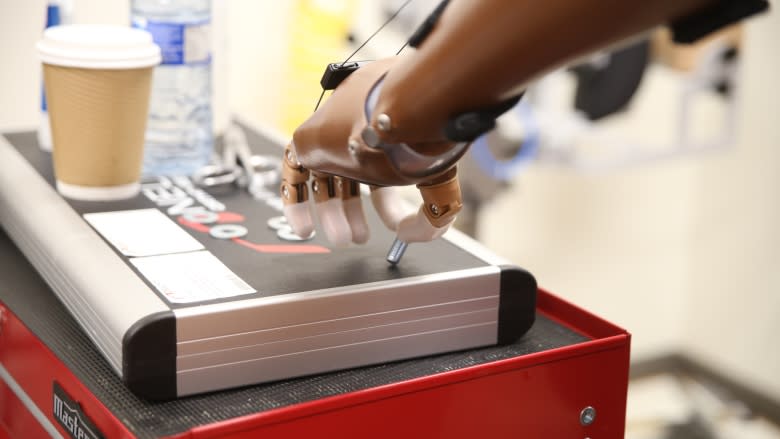 Grateful newcomers hope prosthetic hands will help them grab the Canadian dream