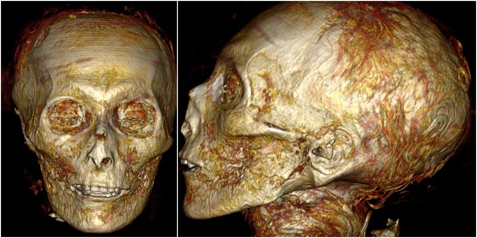 A front and side view of the Amenhotep's skull