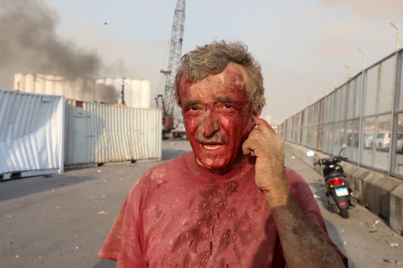 Foto del martes de un hombre ensangrentado tras una explosión en Beirut