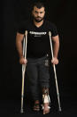 In this Sept. 19, 2018, photo, Mahmoud Saad, 25, poses as he awaits treatment at a Gaza City clinic run by MSF (Doctors Without Borders). Saad says he was throwing rocks while at the border when he was shot in his left leg. (AP Photo/Felipe Dana)