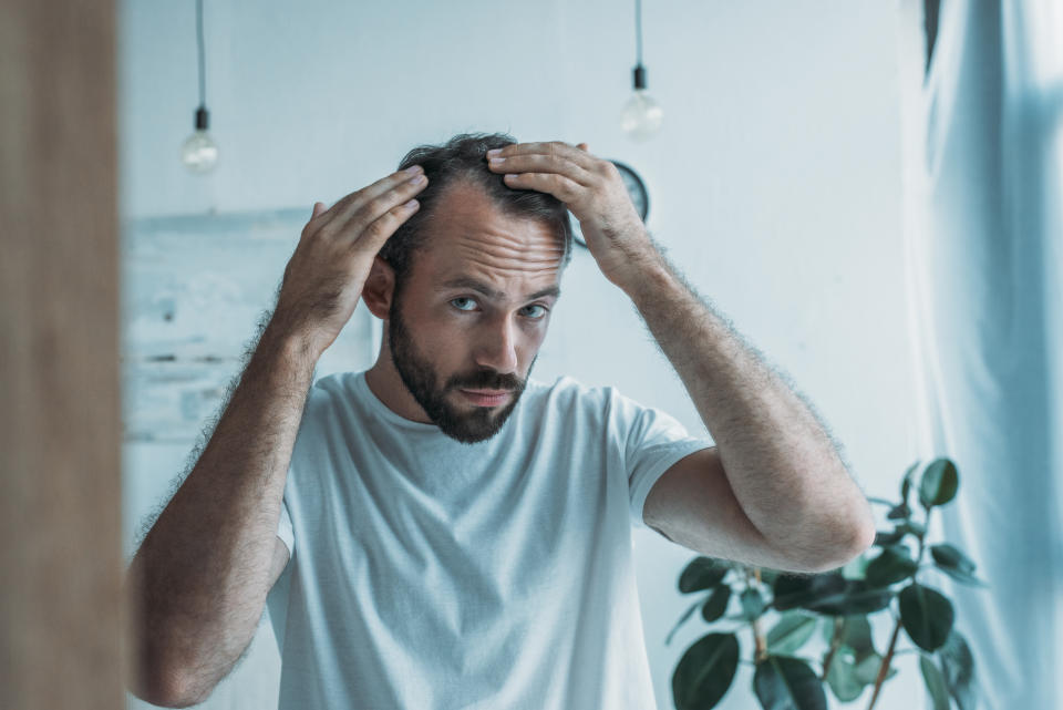 mid adult man with alopecia looking at mirror, hair loss concept 