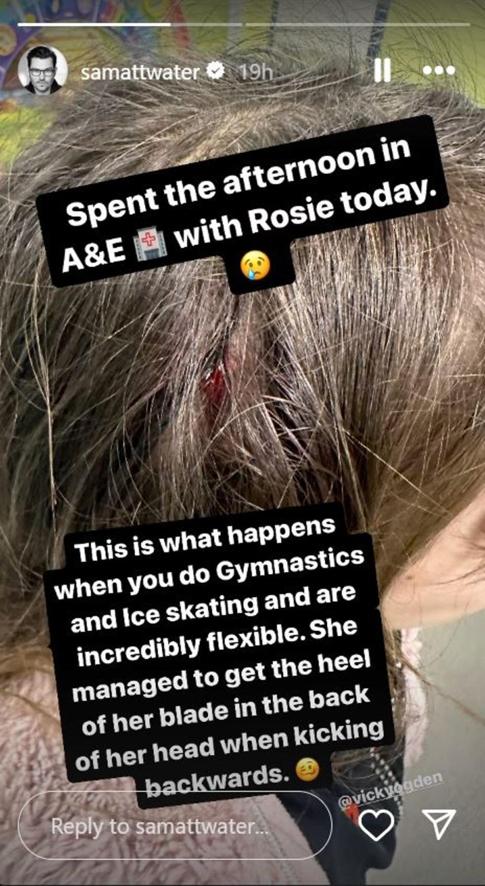 Sam Attwater shared a picture of daughter Rosie’s bloodied head (Instagram @samattwater)