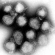 The Hong Kong flu influenza viruses, magnified 100,000 times.