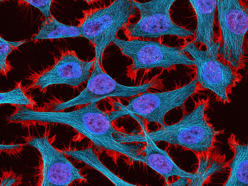 This undated microscope image made available by the National Center for Microscopy and Imaging Research shows HeLa cells.