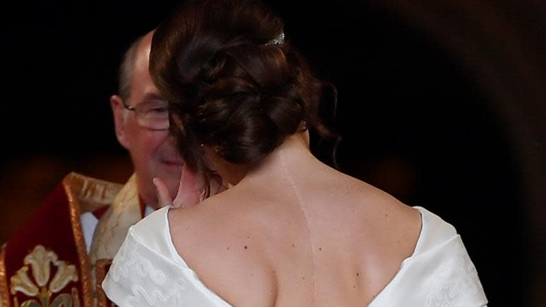 The bride donned a beautiful gown with a low back designed to show off her scar from surgery to correct her scoliosis.