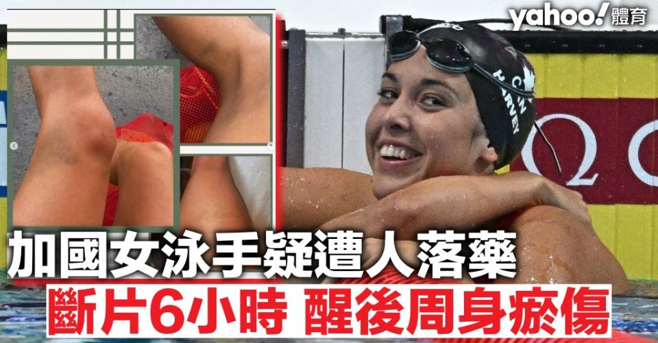 加國女泳手世錦賽後遭人落藥  斷片6小時周身瘀傷