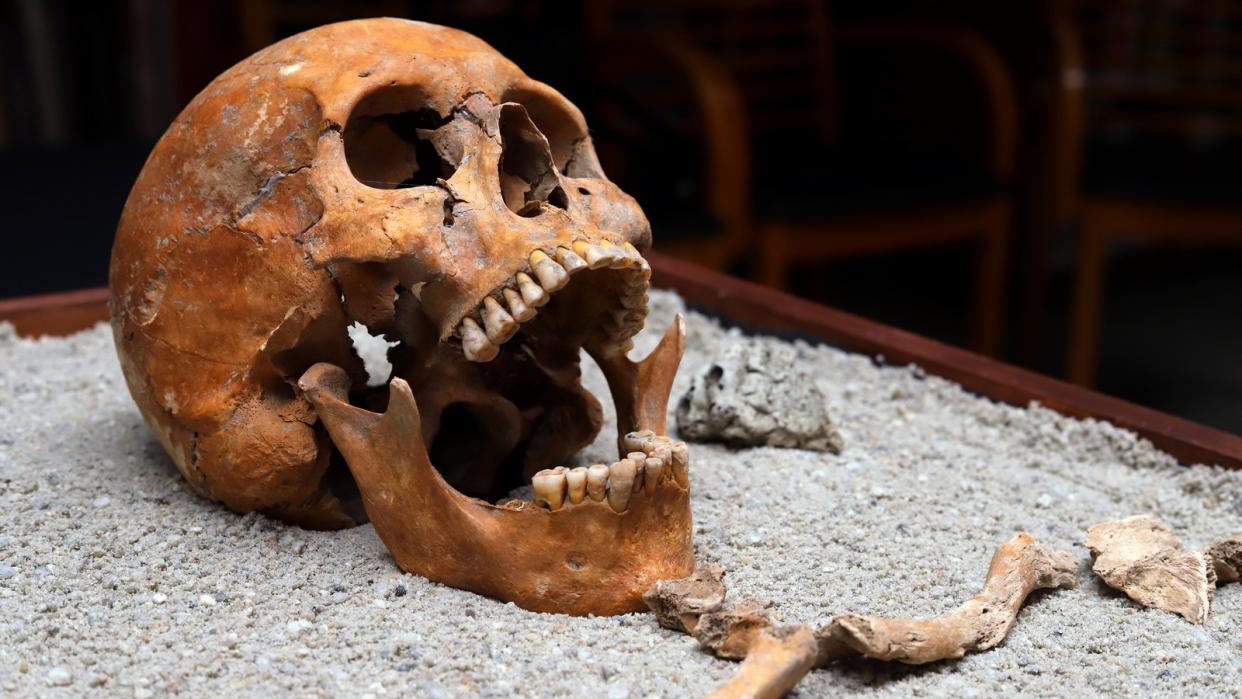  The archaeologists speculate that the physician may have been travelling beyond the frontiers of the Roman Empire to treat someone when he died. Here we see an old human skull on a table. 