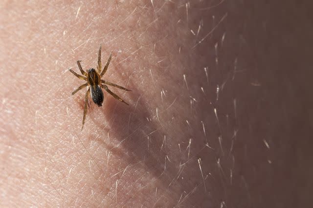 <p>gashgeron</p> Stock image of spider on skin