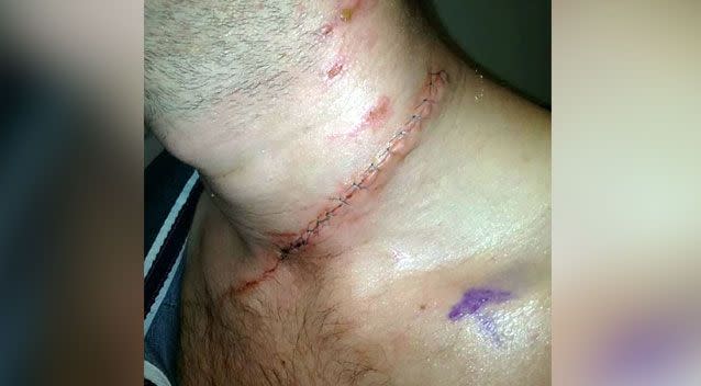 Jodie Goodwin, 20, narrowly missed vital blood vessels and arteries in Anthony Milburn's neck. Photo: Supplied/ SWNS