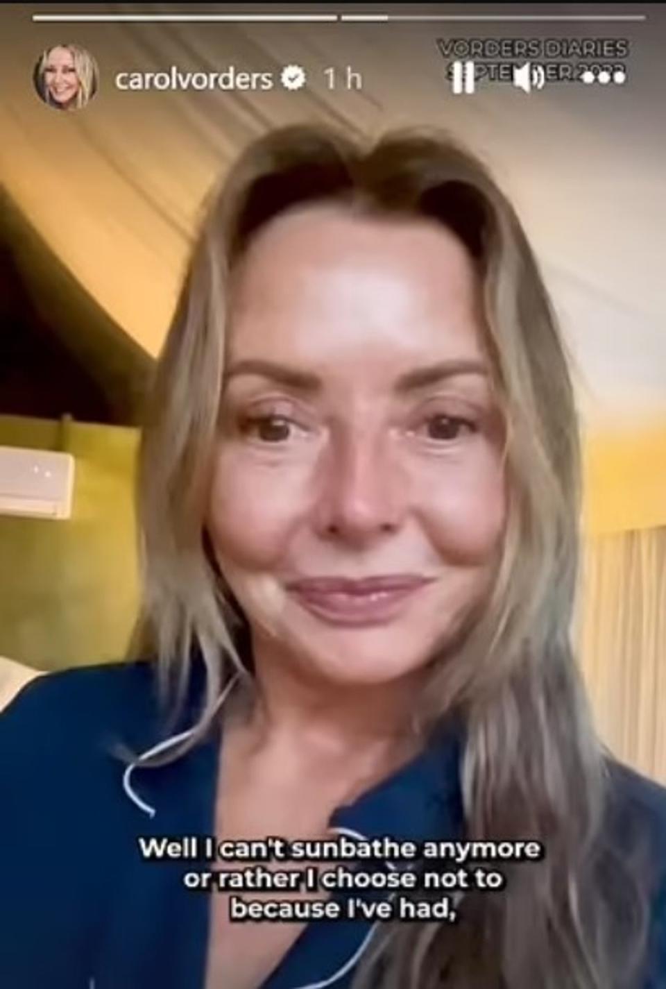 The presenter revealed she previously had undergone a biopsy for skin cancer (Instagram/Carol Vorderman)