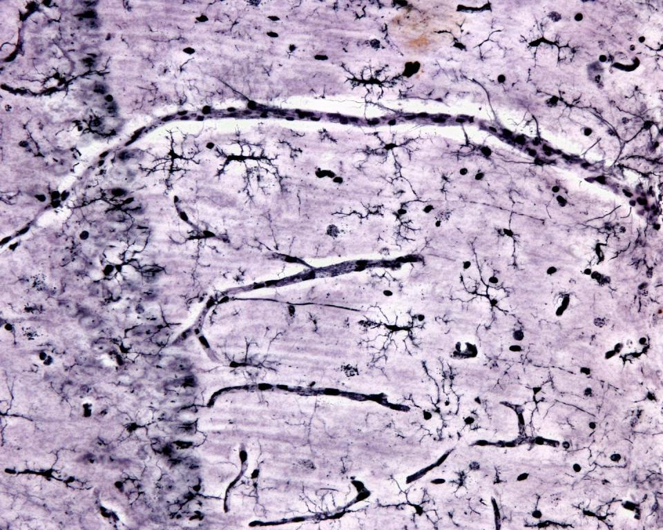 Of the many brain cells (shown in black), giving microglia a boost could help them more effectively clean up debris in the brain. <a href="https://www.gettyimages.com/detail/photo/microglia-silver-carbonate-royalty-free-image/1321565343" rel="nofollow noopener" target="_blank" data-ylk="slk:Jose Luis Calvo Martin & Jose Enrique Garcia-Mauriño Muzquiz/iStock via Getty Images Plus;elm:context_link;itc:0;sec:content-canvas" class="link ">Jose Luis Calvo Martin & Jose Enrique Garcia-Mauriño Muzquiz/iStock via Getty Images Plus</a>