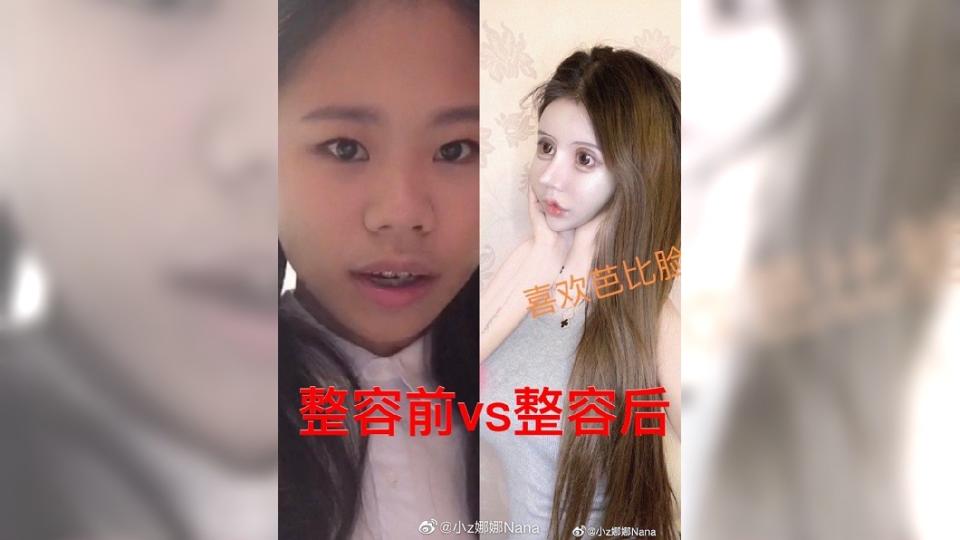 該名女網友自稱16歲，還分享自己整形前後的對比照。(圖／翻攝自微博)