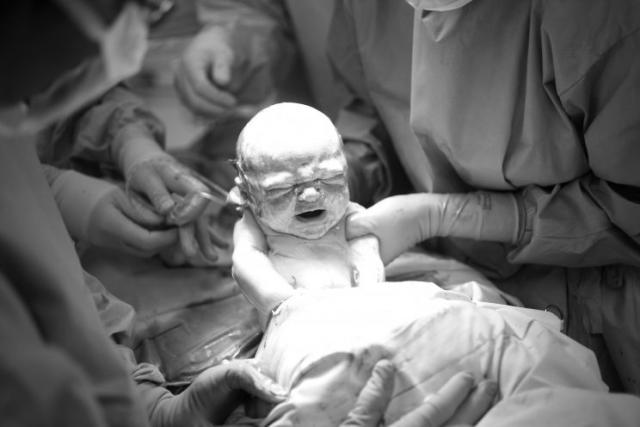 What Are Gentle C-Sections?