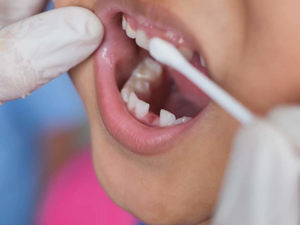 The Liberal government has introduced legislation to implement the first stages of its Canada Dental Benefit. (Shutterstock / chanchai plongern - image credit)