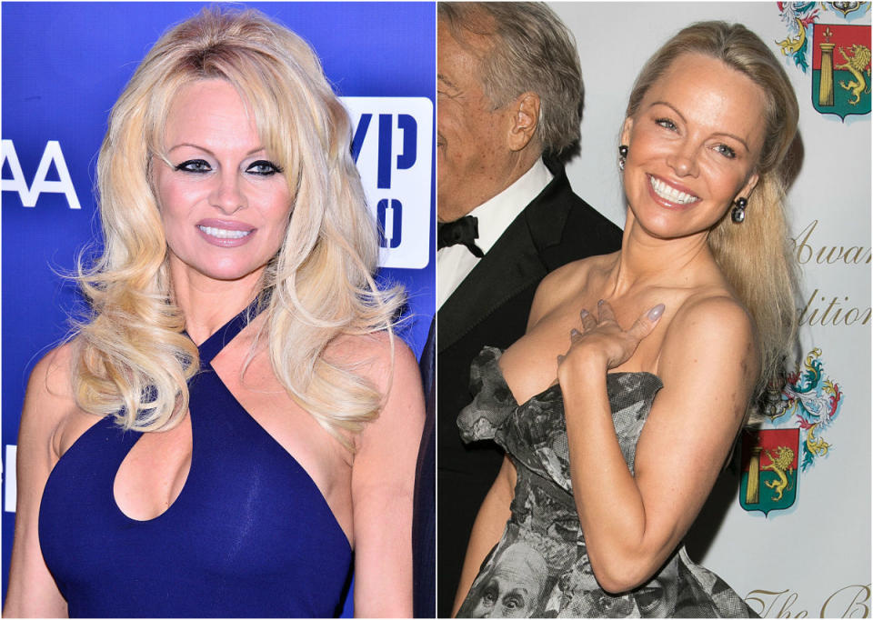 <p>At 49, Pamela Anderson is a complete knockout. The former “Baywatch” babe looked fresh-faced and youthful as she opted for a no-makeup-makeup look at the 40th Best Award Ceremony in Paris. She pulled her iconic blonde locks out of her face and smiled girlishly all night (photo R). A vast difference from the heavy liner and over-plucked brows she used to favour (photo L). Click through the gallery to see more awesome celeb makeunders! <i> (Photos: Getty, 2015/2017) </i> </p>