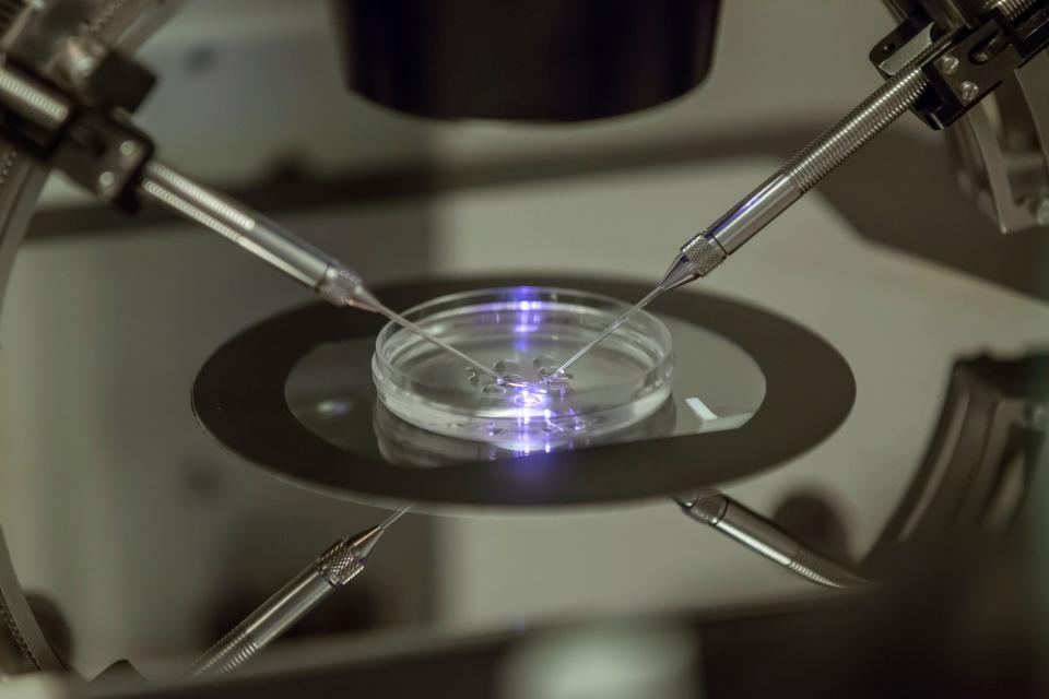 In this Aug. 14, 2013 file photo, an in vitro fertilization embryologist works on a petri dish at a fertility clinic in London. In vitro fertilization involves surgically removing eggs from a woman’s ovaries, combining them with sperm in a laboratory, and transferring the days-old embryo to the woman’s uterus.