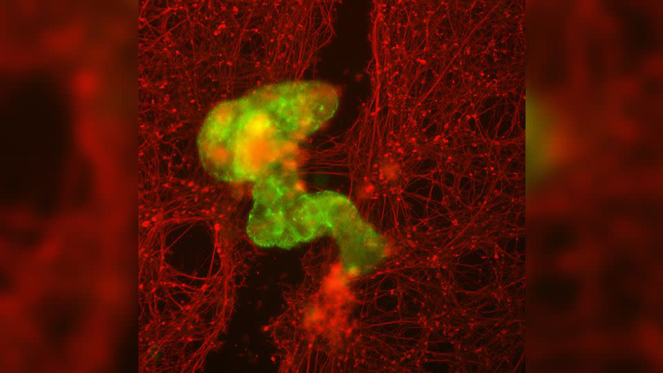 An anthrobot, in green, grows across a scratch through neuronal tissue, in red. - Gizem Gumuskaya, Tufts University