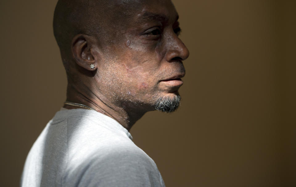 Plaintiff Dewayne Johnson looks on after hearing the verdict in his case against Monsanto at the Superior Court of California in San Francisco on Friday, Aug. 10, 2018. A San Francisco jury on Friday ordered agribusiness giant Monsanto to pay $289 million to the former school groundskeeper dying of cancer, saying the company's popular Roundup weed killer contributed to his disease. (Josh Edelson/Pool Photo via AP)