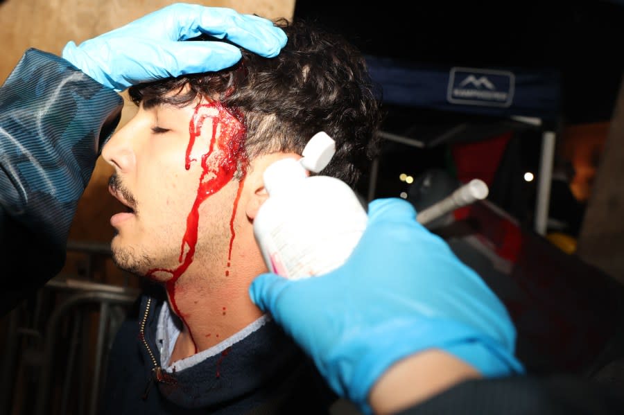 Los Angeles, CA – April 30: A Pro- Palestine group member receives aid from people as be bleeds out from the side of his head out after a scuffle with the pro-Israel group at UCLA on Tuesday, April 30, 2024 in Los Angeles, CA. (Michael Blackshire / Los Angeles Times via Getty Images)