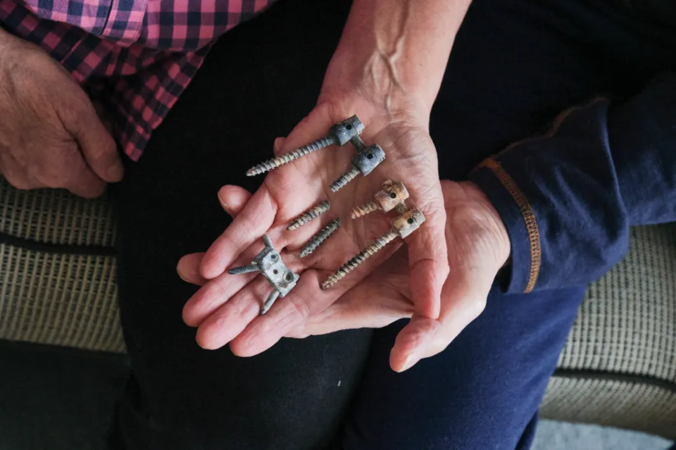 Susan Ottele and Adam Collier’s father, Will Collier, hold the broken screws removed from their son’s back after his 2020 suicide in prison. For years, Adam Collier complained of terrible back pain.