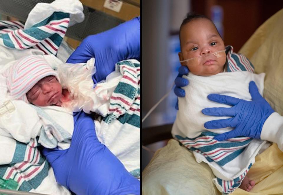 Cheyenne Tomblin was born weighing just 12 ounces on September 11, 2022 and now weighs 9 pounds, 5 ounces, and is ready go home from the West Boca Medical Center in Boca Raton, Florida on March 7, 2023.