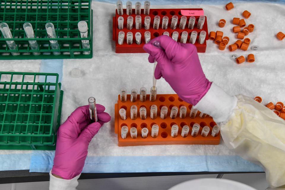 A lab technician sorts blood samples for COVID-19 vaccination study at the Research Centers of America in Hollywood, Florida on August 13, 2020. (Photo by CHANDAN KHANNA / AFP) 