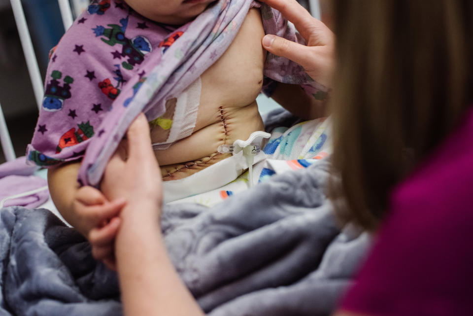 Abby at Children's Hospital of Philadelphia for her liver transplant. (Photo: <a href="https://www.megbrock.com/" target="_blank">Meg Brock Photography</a>)