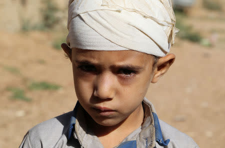 Mukhtar Hadi, who survived last month's Saudi-led air strike that killed dozens including children, stands outside his house in Saada, Yemen September 4, 2018. Picture taken September 4, 2018. REUTERS/Naif Rahma