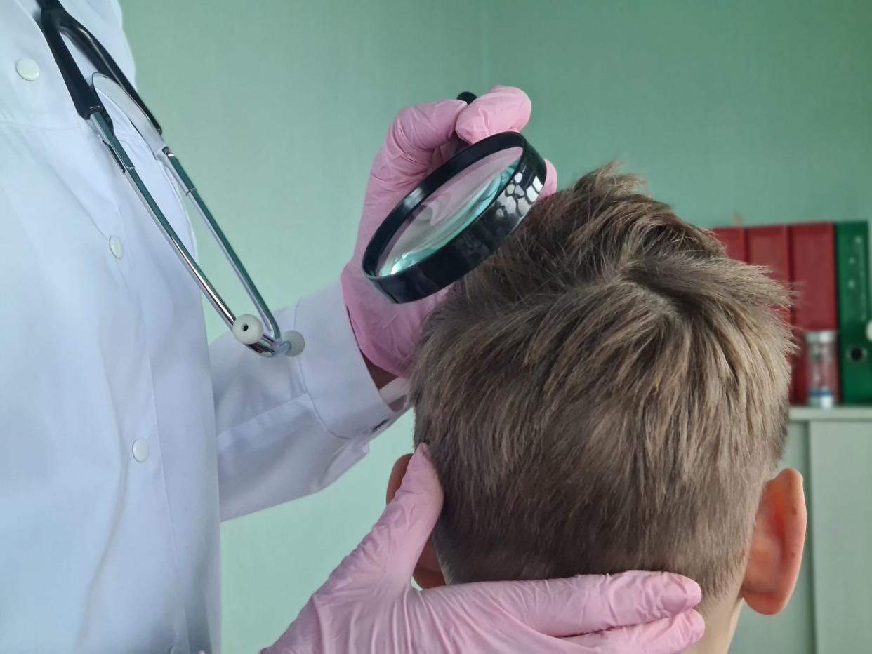 Trichologist examines condition of teenage boyhair. Hair loss in children causes of alopecia and symptoms, lice check