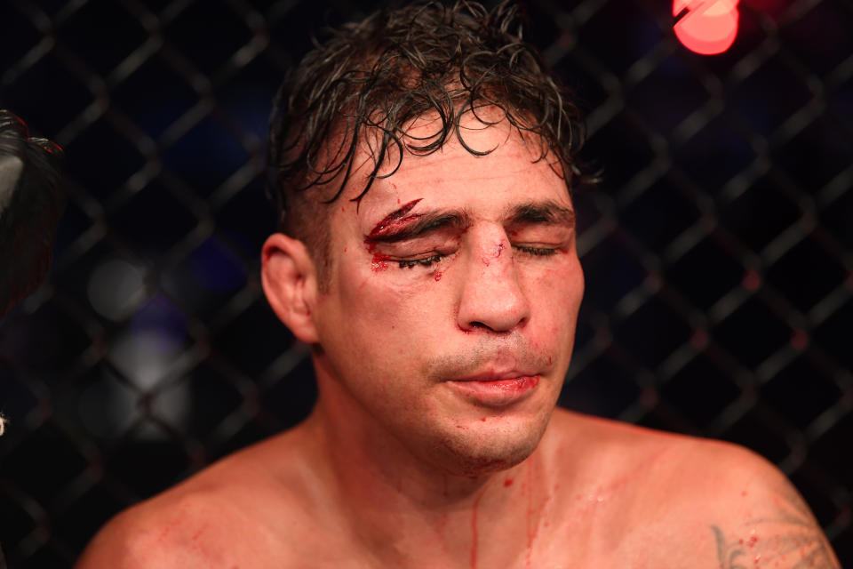 Diego Sanchez has some things to say about the UFC. (Photo by Josh Hedges/Zuffa LLC)