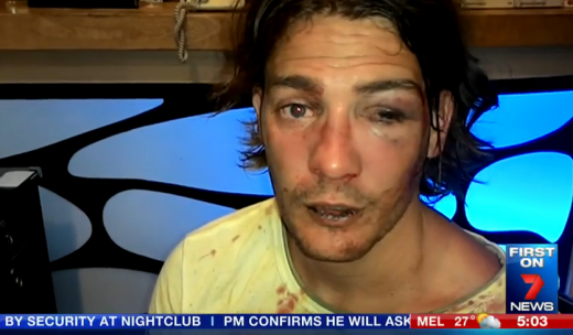 Photo: The unnamed man claims the nightclub security attacked him after he confronted a 'pick pocket'.